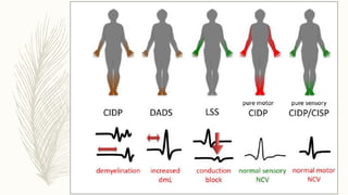 Aidp Graph Variants of AIDP & CIDP.pptx