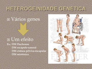  Vários genes
 Um efeito
Ex.: DM Duchenne
DM escápulo-umeral
DM cintura pélvica-éscapular
DM miotônica
 