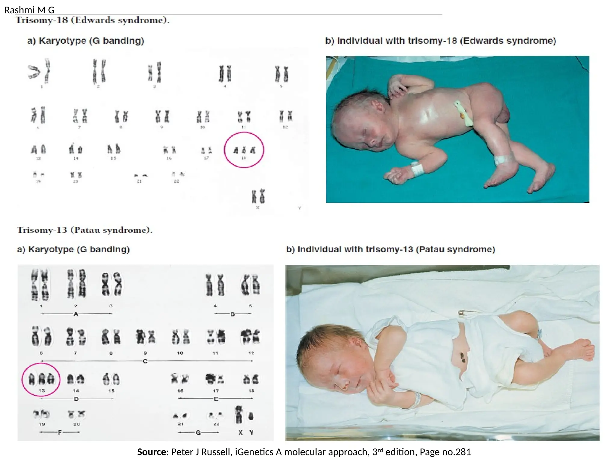 Rashmi M G
Source: Peter J Russell, iGenetics A molecular approach, 3rd
edition, Page no.281
 