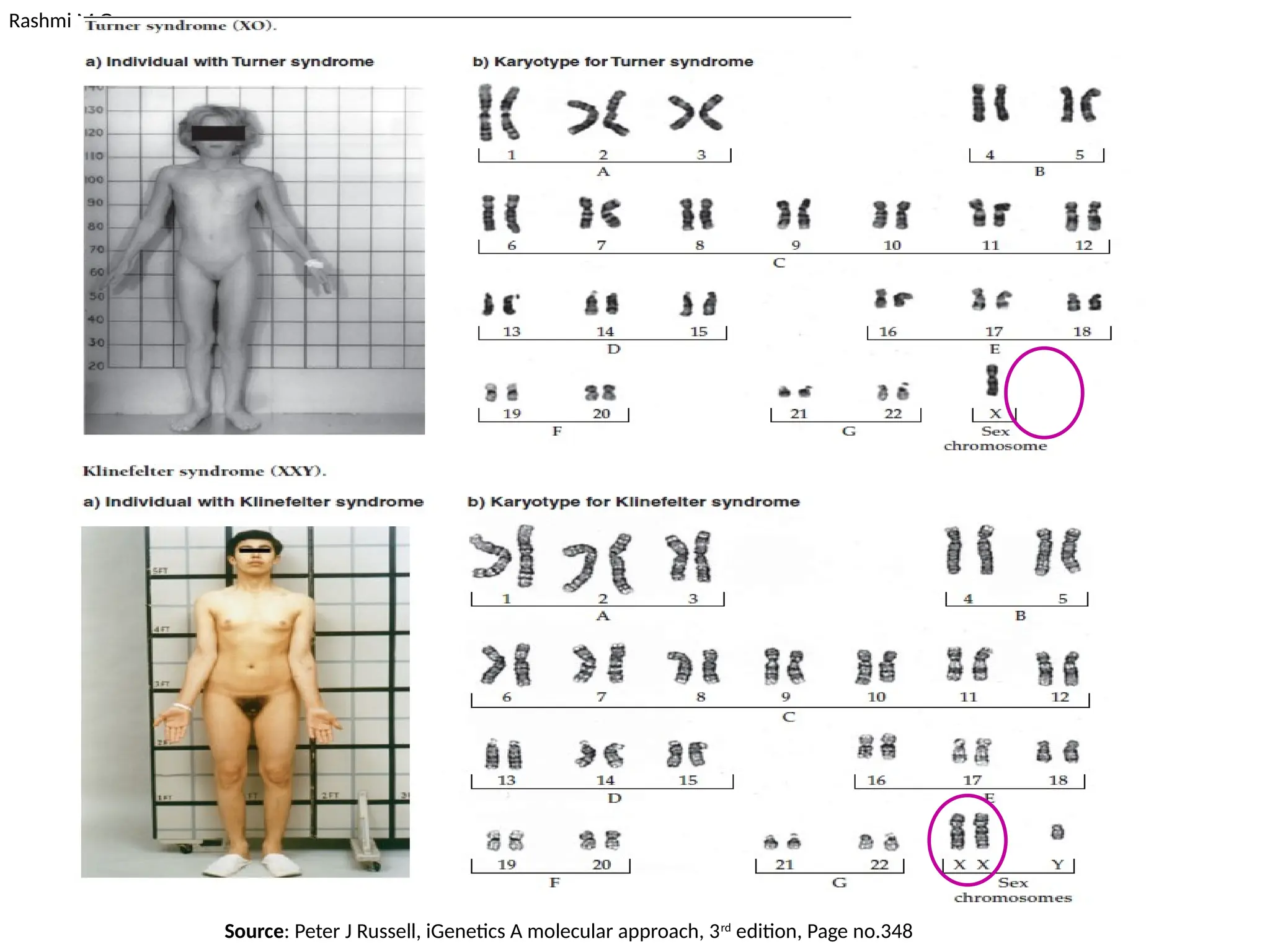Rashmi M G
Source: Peter J Russell, iGenetics A molecular approach, 3rd
edition, Page no.348
 
