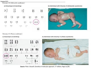 Rashmi M G
Source: Peter J Russell, iGenetics A molecular approach, 3rd
edition, Page no.281
 