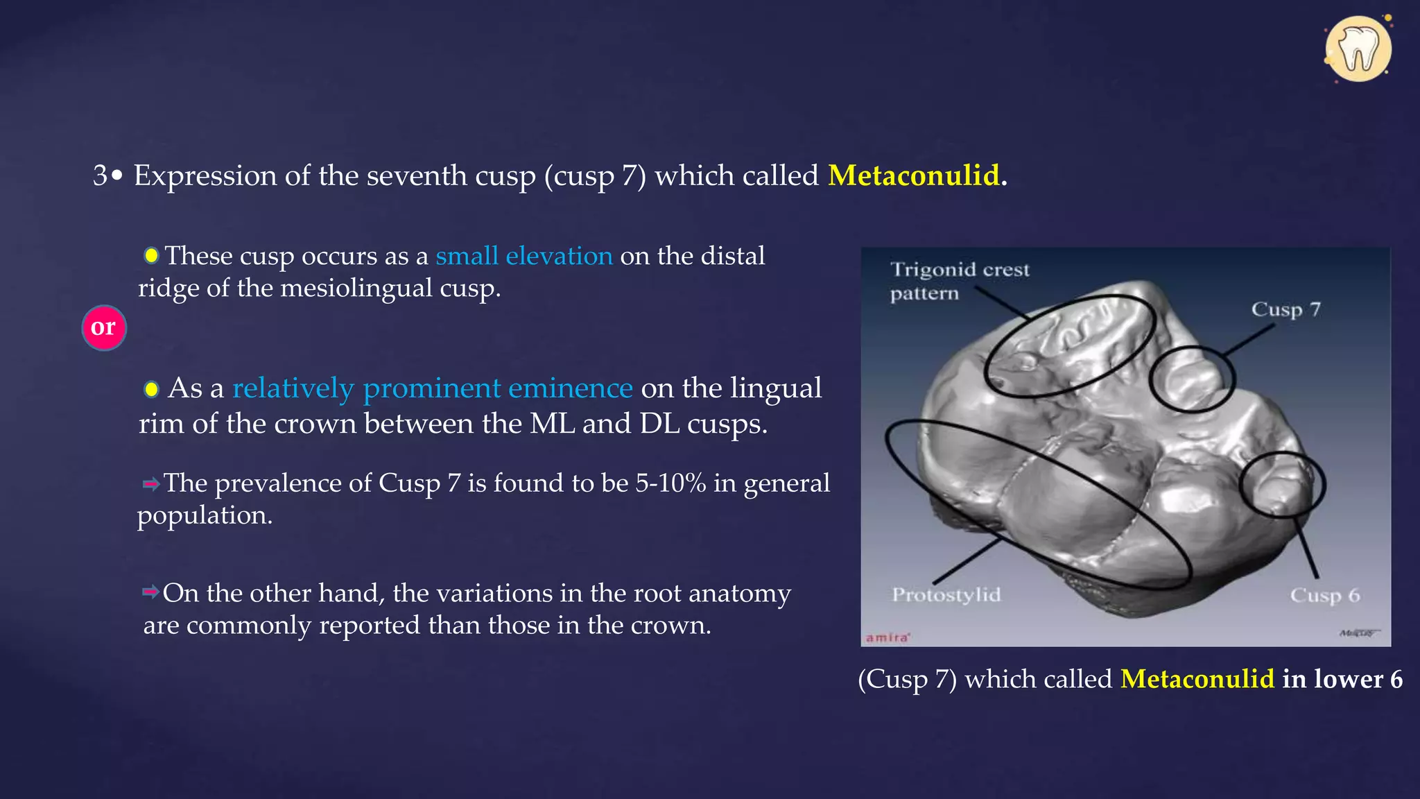 3• Expression of the seventh cusp (cusp 7) which called Metaconulid.
These cusp occurs as a small elevation on the distal
ridge of the mesiolingual cusp.
or
As a relatively prominent eminence on the lingual
rim of the crown between the ML and DL cusps.
The prevalence of Cusp 7 is found to be 5-10% in general
population.
On the other hand, the variations in the root anatomy
are commonly reported than those in the crown.
(Cusp 7) which called Metaconulid in lower 6
 