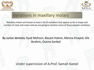 Variations in maxillary molars
By Junior dentists: Eyad Mohsen, Basant Hatem, Menna Elsayed, Ola
Ibrahim, Osama Sonbol
Maxillary molars are known to have a lot of variations that appear to be in shape and
number of roots and crown and we are going to mention some of these popular variations.
Under supervision of A.Prof. Samah Kamel
 