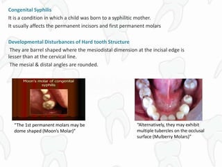 Congenital Syphilis
It is a condition in which a child was born to a syphilitic mother.
It usually affects the permanent incisors and first permanent molars
Developmental Disturbances of Hard tooth Structure
They are barrel shaped where the mesiodistal dimension at the incisal edge is
lesser than at the cervical line.
The mesial & distal angles are rounded.
“The 1st permanent molars may be
dome shaped (Moon’s Molar)”
“Alternatively, they may exhibit
multiple tubercles on the occlusal
surface (Mulberry Molars)”
 