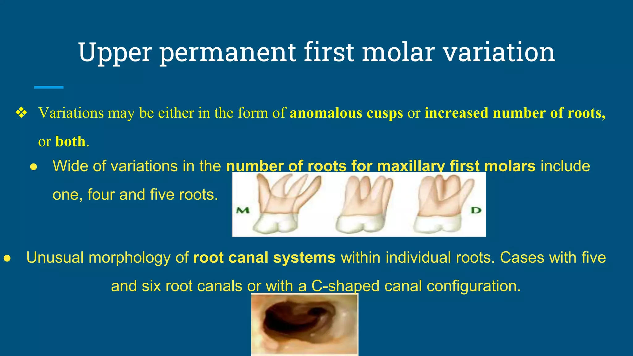 Upper permanent first molar variation
❖ Variations may be either in the form of anomalous cusps or increased number of roots,
or both.
● Wide of variations in the number of roots for maxillary first molars include
one, four and five roots.
● Unusual morphology of root canal systems within individual roots. Cases with five
and six root canals or with a C-shaped canal configuration.
 