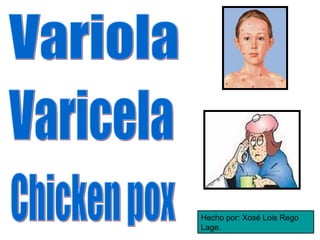 Hecho por: Xosé Lois Rego Lage. Varicela Variola Chicken pox 
