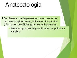 Anatopatologia
 Inmunosupresores hay replicación en pulmón y
cerebro
Se observa una degeneración balonizantes de
las células epidérmicas , infiltración linfocitarias
y formación de células gigante multinucleadas.
 