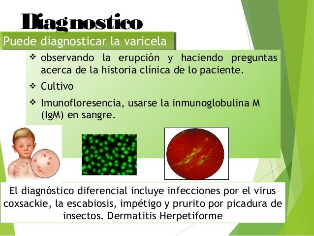 Como se librará de la psoriasis sobre la persona por los medios públicos