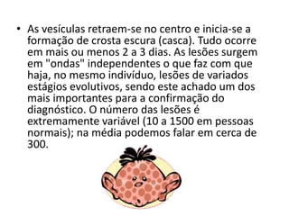 • As vesículas retraem-se no centro e inicia-se a 
formação de crosta escura (casca). Tudo ocorre 
em mais ou menos 2 a 3 dias. As lesões surgem 
em "ondas" independentes o que faz com que 
haja, no mesmo indivíduo, lesões de variados 
estágios evolutivos, sendo este achado um dos 
mais importantes para a confirmação do 
diagnóstico. O número das lesões é 
extremamente variável (10 a 1500 em pessoas 
normais); na média podemos falar em cerca de 
300. 
 