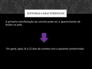 A primeira manifestação da varicela pode ser o aparecimento de
lesões na pele.
SINTOMAS CARACTERÍSTICOS
Em geral, após 14 a 21 dias do contato com o paciente contaminado.
 