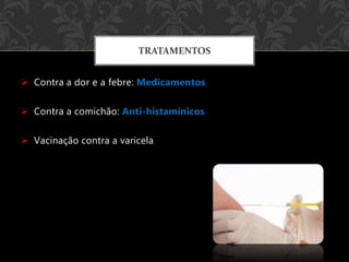 Contra a dor e a febre: Medicamentos
 Contra a comichão: Anti-histamínicos
 Vacinação contra a varicela
TRATAMENTOS
 