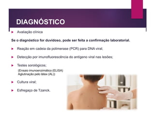 DIAGNÓSTICO
 Avaliação clínica
Se o diagnóstico for duvidoso, pode ser feita a confirmação laboratorial.
 Reação em cadeia da polimerase (PCR) para DNA viral;
 Detecção por imunofluorescência do antígeno viral nas lesões;
 Testes sorológicos;
 Cultura viral;
 Esfregaço de Tzanck.
(Ensaio imunoenzimático (ELISA)
Aglutinação pelo látex (AL))
 