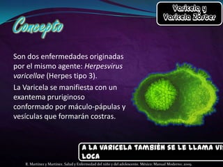 Son dos enfermedades originadas
por el mismo agente: Herpesvirus
varicellae (Herpes tipo 3).
La Varicela se manifiesta con un
exantema pruriginoso
conformado por máculo-pápulas y
vesículas que formarán costras.

A la Varicela también se le llama Vir
Loca
R. Martínez y Martínez. Salud y Enfermedad del niño y del adolescente. México: Manual Moderno; 2009.

 