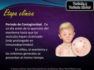 Período de Contagiosidad. De
un día antes de la aparición del
exantema hasta que las
vesículas hayan cicatrizado
(más prolongado en
inmunodeprimidos).
En niños, el exantema y
los síntomas generales se
presentan al mismo tiempo.

R. Martínez y Martínez. Salud y Enfermedad del niño y del adolescente. México: Manual Moderno; 2009.

 