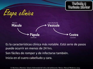 Mancha

Llena de líquido

Sobresale

Curación

Es la características clínica más notable. Está serie de pasos
puede ocurrir en menos de 24 hrs.
Son fáciles de romper y de infectarse también.
Inicia en el cuero cabelludo y cara.
R. Martínez y Martínez. Salud y Enfermedad del niño y del adolescente. México: Manual Moderno; 2009.

 