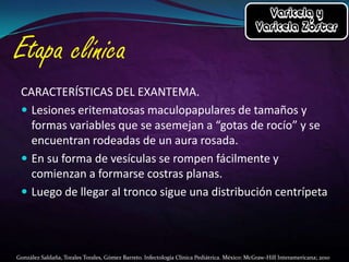 CARACTERÍSTICAS DEL EXANTEMA.
 Lesiones eritematosas maculopapulares de tamaños y
formas variables que se asemejan a “gotas de rocío” y se
encuentran rodeadas de un aura rosada.
 En su forma de vesículas se rompen fácilmente y
comienzan a formarse costras planas.
 Luego de llegar al tronco sigue una distribución centrípeta

González Saldaña, Torales Torales, Gómez Barreto. Infectología Clínica Pediátrica. México: McGraw-Hill Interamericana; 2010

 