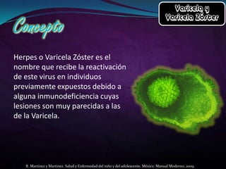 Herpes o Varicela Zóster es el
nombre que recibe la reactivación
de este virus en individuos
previamente expuestos debido a
alguna inmunodeficiencia cuyas
lesiones son muy parecidas a las
de la Varicela.

R. Martínez y Martínez. Salud y Enfermedad del niño y del adolescente. México: Manual Moderno; 2009.

 