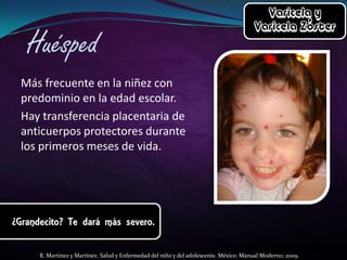 Más frecuente en la niñez con
predominio en la edad escolar.
Hay transferencia placentaria de
anticuerpos protectores durante
los primeros meses de vida.

R. Martínez y Martínez. Salud y Enfermedad del niño y del adolescente. México: Manual Moderno; 2009.

 