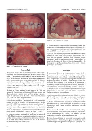 Acta Pediatr Port 2010:41(5):217-21

Figura 1 – Cárie precoce da infância

Areias C et al. – Cárie precoce da infância

Figura 3 – Cárie precoce da infância

A estratégia europeia e as metas definidas para a saúde oral,
pela OMS, apontam para que, no ano 2020, pelo menos 80%
das crianças com seis anos estejam livres de cárie e, aos doze
anos, o CPOD não ultrapasse o valor de 1.5 8,9.
Apesar de toda a estratégia preventiva, que pode reduzir a prevalência de cárie, existe ainda patologia remanescente para a
qual urge dar resposta, evitando assim frequentes consequências: a perda da função mastigatória, a infecção local ou
geral, as alterações do desenvolvimento da dentição e da
linguagem, os problemas de estética, bem como o trauma
psicológico resultante8,9.
Figura 2 – Cárie precoce da infância

Epidemiologia

Prevenção

Das doenças orais, a cárie é a mais frequente em todos os grupos etários bem como a principal causa de perda de peças dentárias4-6. Os dados disponíveis apontam para a existência de
níveis de doença entre a população portuguesa, estando colocados entre os países com moderada prevalência da doença,
com indicadores aos 12 anos de idade (índice cariados, perdidos e obturados, cpo = 2,95) compatíveis com os preconizados pela OMS (Organização Mundial de Saúde) para a região
Europeia (cpo = 3)5,6.

É fundamental desenvolver em parceria com os pais, desde a
primeira consulta, um plano preventivo e educacional, que
contemple o meio sócio-cultural e familiar da criança. O controlo dos principais factores etiológicos poderá ter influência
no grau de gravidade da doença. Cuidados específicos e diferenciados no tratamento e na prevenção na assistência à
criança obrigam à estreita colaboração entre o pediatra e o
odontopediatra, bem como à educação dos pais2,3 (Quadro).

Mediante o Estudo Nacional de Prevalência de Cárie na
População Escolarizada, publicado em 2000, que incidiu nas
idades seis, doze e quinze anos, verificou-se, que a percentagem de indivíduos livres de cárie, a nível nacional, era de
33%, 27% e de 18,9%, respectivamente.
A prevalência de cárie em Portugal varia de região para região
estando descrita na literatura em percentagens que variam
entre 23 e 33% (na faixa etária descrita anteriormente)7,8.
Vários factores explicam estas diferenças, nomeadamente, a
educação para a saúde, os hábitos alimentares e os diferentes
níveis de concretização de programas de saúde oral, aspectos
que se devem considerar nos cuidados de saúde à criança7-9.
As crianças com risco aumentado de problemas de saúde oral
e dificuldades no acesso aos cuidados médicos pertencem a
famílias pobres, sem instrução, minorias étnicas e sem seguros de saúde. Estes factores colocam mais de 52% de crianças
em risco de doença oral não tratada8,9.
218

A prevenção deve ser vista como base para uma educação que
proporcione as condições para um óptimo crescimento,
desenvolvimento e funcionamento.
As consultas de odontopediatria têm como objectivo a promoção da saúde oral e a prevenção das patologias mais frequentes, nomeadamente a cárie e as maloclusões9 (Figuras 1- 3).
A criança, o encarregado de educação ou responsável deverão
receber explicação sobre higiene oral, incluindo o bochecho
fluoretado (a partir 5 anos), dentífrico fluoretado e educação
alimentar10.
Para o sucesso da consulta, e uma vez que o medo da criança
está directamente ligado à ansiedade dos pais, é fundamental
que se transmita segurança à criança e se descreva com adequada antecedência os procedimentos a efectuar11.
Existem diversas técnicas de controlo de comportamento não
farmacológicas e farmacológicas para um melhor e maior
controlo do paciente pediátrico. Segundo a American Aca-

 