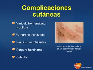 Complicaciones
cutáneas
Varicela hemorrágica
y bullosa
Gangrena localizada
Fascitis necrotizantes
Púrpura fulminante
Celulitis
Superinfección bacteriana
en un paciente con herpes
zoster
 