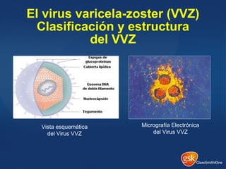 El virus varicela-zoster (VVZ)
Clasificación y estructura
del VVZ
Vista esquemática
del Virus VVZ
Micrografía Electrónica
del Virus VVZ
 