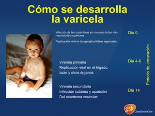 Cómo se desarrolla
la varicela
Infección de las conjuntivas y/o mucosa de las vías
respiratorias superiores
Replicación viral en los ganglios lifátios regionales
Viremia primaria
Replicación viral en el hígado,
bazo y otros órganos
Día 0
Día 4-6
Viremia secundaria
Infección cutánea y aparición
Del exantema vesicular
Día 14
Periododeencuvación
 