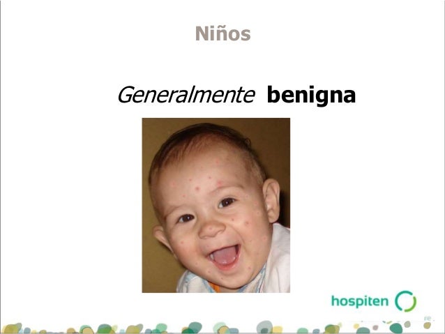 Los preparados de atopicheskogo de la dermatitis y su precio