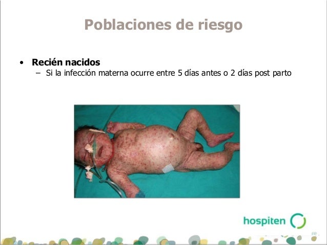 La eccema inguinal a los hombres el tratamiento