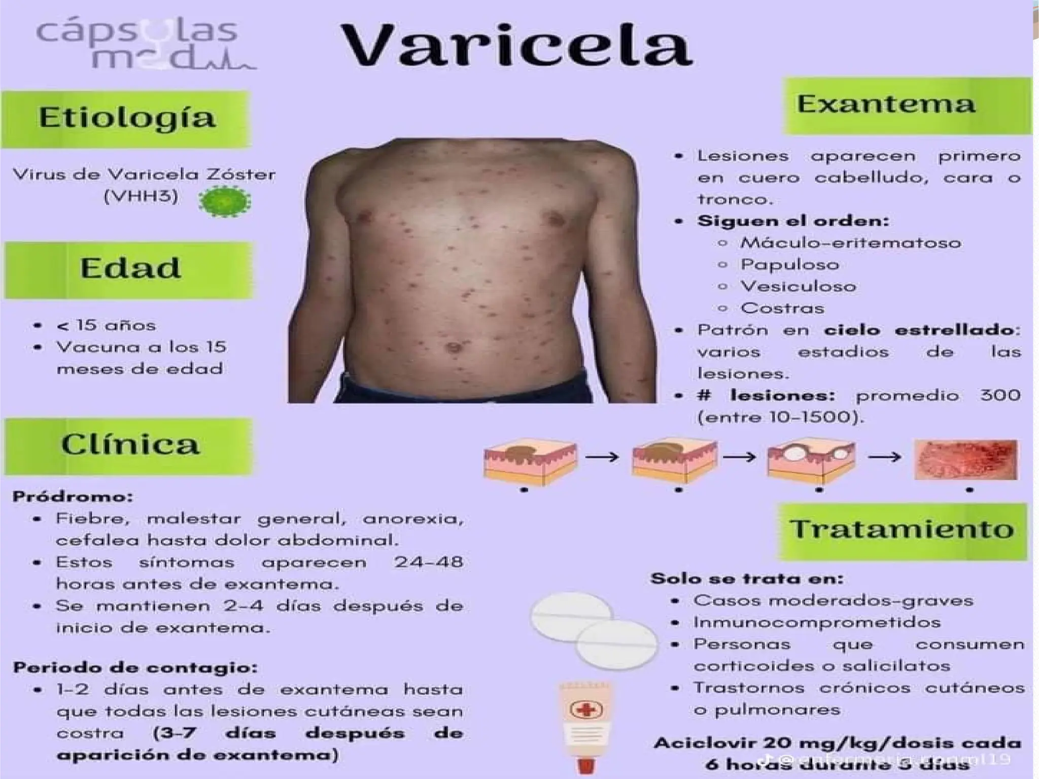 Varicela y Escarlatina 2 de las Enfermedades Exantematicas PPT