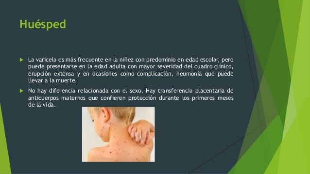 Varicela y exantema súbito