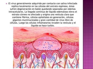 El virus generalmente adquirido por contacto con saliva infectada replica localmente en las células del extrato espinoso, éstas sufren degeneración en balón quedando separadas por edemas intracelulares. La llegada contínua de líquido edematoso eleva el estrato córneo no afectado y origina una vesícula clara que contiene fibrina, células epiteliales en generación, células gigantes muntinucleadas y gran cantidad de virus libre de células. Luego las células inflamatorias invaden la vesícula y el líquido se hace turbio.