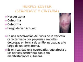 Herpes zoster (serpiente y cintura)Herpes zonaCulebrillaCulebrinaFuego de San AntonioEs una reactivación del virus de la varicela caracterizada por pequeñas ampollas dolorosas en forma de anillo agrupadas a lo largo de un dermatoma.Es en realidad una neuropatía, que afecta a los nervios periféricos con o sin manifestaciones cutáneas.