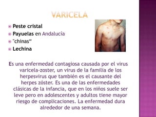 varicelaPestecristalPayuelas en Andalucía"chinas“LechinaEs una enfermedad contagiosa causada por el virus varicela-zoster, un virus de la familia de los herpesvirus que también es el causante del herpes zóster. Es una de las enfermedades clásicas de la infancia, que en los niños suele ser leve pero en adolescentes y adultos tiene mayor riesgo de complicaciones. La enfermedad dura alrededor de una semana.
