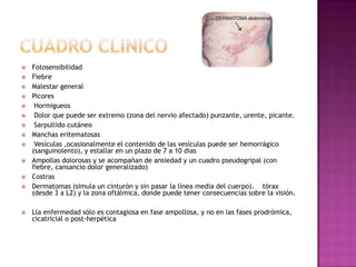 CuadroclinicoFotosensibilidadFiebre  Malestar general Picores Hormigueos  Dolor que puede ser extremo (zona del nervio afectado) punzante, urente, picante. Sarpullido cutáneoManchas eritematosas  Vesículas ,ocasionalmente el contenido de las vesículas puede ser hemorrágico (sanguinolento), y estallar en un plazo de 7 a 10 díasAmpollas dolorosas y se acompañan de ansiedad y un cuadro pseudogripal (con fiebre, cansancio dolor generalizado)CostrasDermatomas (simula un cinturón y sin pasar la línea media del cuerpo).    tórax (desde 3 a L2) y la zona oftálmica, donde puede tener consecuencias sobre la visión. Lla enfermedad sólo es contagiosa en fase ampollosa, y no en las fases prodrómica, cicatricial o post-herpética