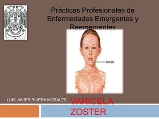 Prácticas Profesionales de
                 Enfermedades Emergentes y
                        Reemergentes




LUIS JAVIER RIVERA MORALES
                             VARICELA
                             ZOSTER
 