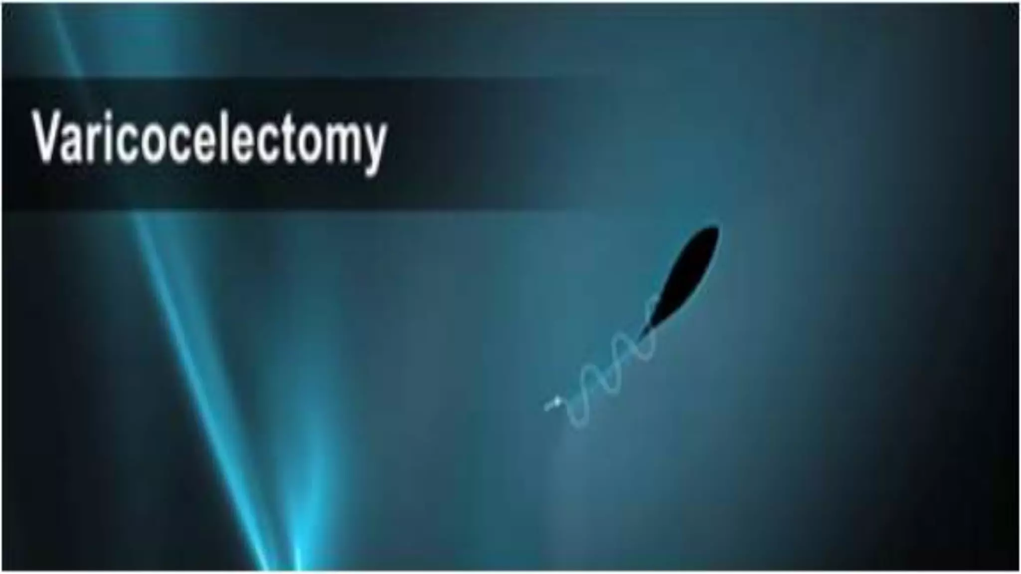 Varicocelectomy | PPTX