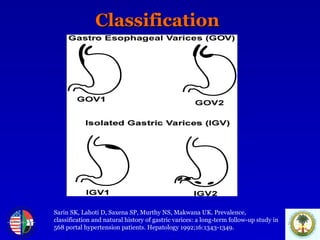 Classification Sarin SK, Lahoti D, Saxena SP, Murthy NS, Makwana UK. Prevalence, classification and natural history of gastric varices: a long-term follow-up study in 568 portal hypertension patients. Hepatology 1992;16:1343-1349. 