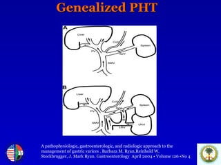 Genealized PHT A pathophysiologic, gastroenterologic, and radiologic approach to the  management of gastric varices . Barbara M. Ryan,Reinhold W.  Stockbrugger, J. Mark Ryan. Gastroenterology  April 2004 • Volume 126 •No 4 