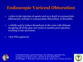 Endoscopic Variceal Obturation  •   refers to the injection of agents such as n-butyl-2-cyanoacrylate (Histoacryl), isobutyl-2-cyanoacrylate (Bucrylate), or thrombin.  •   solidify and/or induce thrombosis in the varix with ultimate sloughing off of the glue cast weeks to months post-injection, resulting in late ulceration.  •   Not FDA approved. A pathophysiologic, gastroenterologic, and radiologic approach to the  management of gastric varices . Barbara M. Ryan,Reinhold W.  Stockbrugger, J. Mark Ryan. Gastroenterology  April 2004 • Volume 126 •No 4 