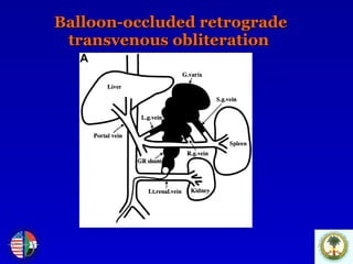 Balloon-occluded retrograde transvenous obliteration  