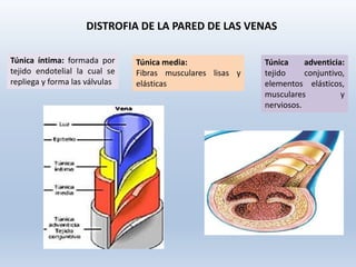 Túnica íntima: formada por
tejido endotelial la cual se
repliega y forma las válvulas
Túnica media:
Fibras musculares lisas y
elásticas
Túnica adventicia:
tejido conjuntivo,
elementos elásticos,
musculares y
nerviosos.
DISTROFIA DE LA PARED DE LAS VENAS
 
