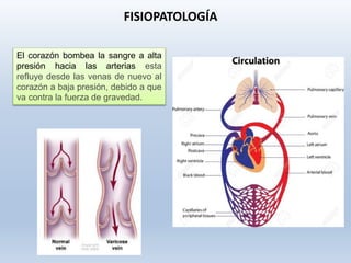 El corazón bombea la sangre a alta
presión hacia las arterias esta
refluye desde las venas de nuevo al
corazón a baja presión, debido a que
va contra la fuerza de gravedad.
FISIOPATOLOGÍA
 