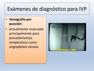 Exámenes de diagnóstico para IVP
• Venografía por
punción:
• Actualmente reservada
principalmente para
procedimientos
terapéuticos como
angioplastía venosa
 