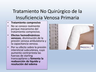Tratamiento No Quirúrgico de la
Insuficiencia Venosa Primaria
• Tratamiento compresivo
• No se conoce realmente
porque mecanismo del
tratamiento compresivo.
• Efectos hemodinámicos
venosos, disminución de la
presión venosa ambulatoria y
la capacitancia venosa.
• Por su efecto sobre la presión
intersticial subcutánea, cuyo
aumento contrarresta las
fuerzas de starling
transcapilares y fomenta la
reabsorción de líquido y
resolución del edema
 