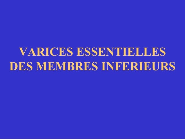 Les veines variqueuses traiter les maisons