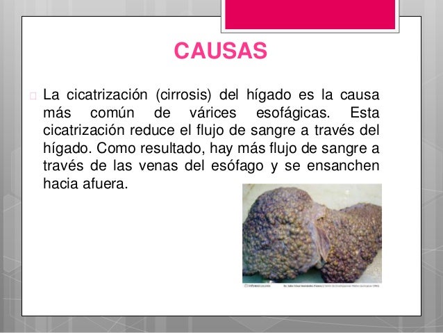De la cirugía vascular el centro surgut