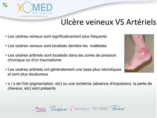 Ulcère veineux VS Artériels •  Les ulcères veineux sont significativement plus fréquents •  Les ulcères veineux sont localisés derrière les  malléoles •  Les ulcères artériels sont localisés dans les zones de pression  chronique ou d'un traumatisme •  Les ulcères artériels ont généralement une base plus nécrotiques  et sont plus douloureux •  s / s de l'icb (pigmentation, etc) ou une ischémie (absence d'impulsions, la perte de  cheveux, etc) sont présents 