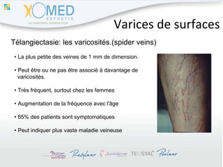 Varices de surfaces Télangiectasie: les varicosités.(spider veins) •  La plus petite des veines de 1 mm de dimension. •  Peut être ou ne pas être associé à davantage de  varicosités. •  Très fréquent, surtout chez les femmes •  Augmentation de la fréquence avec l'âge •  85% des patients sont symptomatiques  •  Peut indiquer plus vaste maladie veineuse 