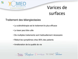 Varices de surfaces Traitement des télangiectasies •  La sclérothérapie est le traitement le plus efficace •  Le laser peut être utile •  De multiples traitements sont habituellement nécessaire •  Réduit les symptômes chez 85% des patients •  Amélioration de la qualité de vie 