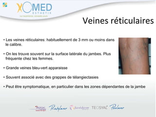 Veines réticulaires •  Les veines réticulaires: habituellement de 3 mm ou moins dans  le calibre.  •  On les trouve souvent sur la surface latérale du jambes. Plus  fréquente chez les femmes. •  Grande veines bleu-vert apparaisse •  Souvent associé avec des grappes de télangiectasies •  Peut être symptomatique, en particulier dans les zones dépendantes de la jambe 
